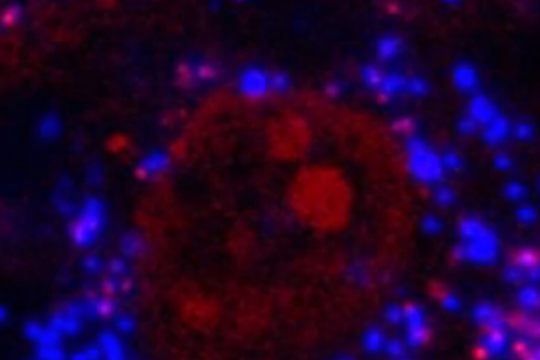 Phát hiện vi nhựa xuất hiện trong xương người