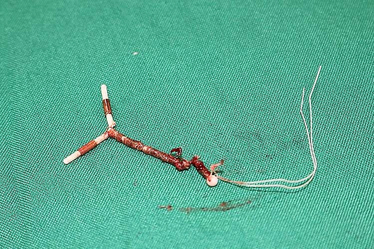 Đánh đổi sức khỏe để giữ 'phong độ' cho chồng