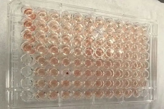 Phát hiện người mang 'máu kim cương' ở Trung Quốc