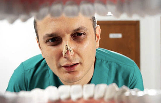 Hôi miệng và cách phòng tránh