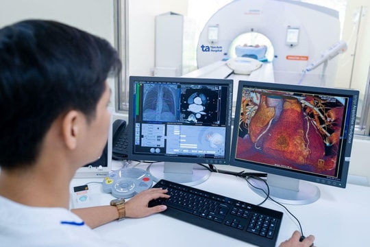 Ai nên chụp CT tầm soát nhồi máu cơ tim?