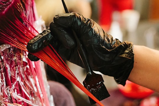 Nhuộm tóc hàng tháng theo thần tượng, cô gái 20 tuổi viêm thận