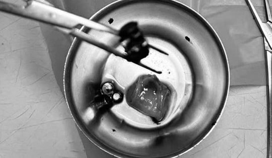 Bé trai 4 tuổi đau bụng dữ dội, nôn ói, bác sĩ gắp ra thứ "đáng sợ" bên trong