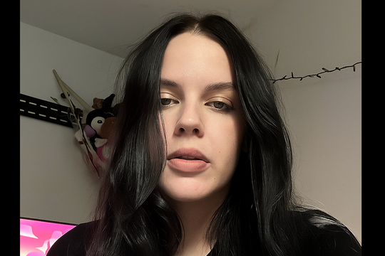 Mất hết răng ở tuổi 21