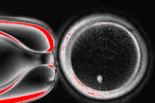 Đột phá tạo ra tế bào trứng từ tế bào da người