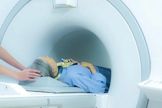 Chuyên gia: 'Không phải ai cũng nên chụp CT tầm soát ung thư, đột quỵ'