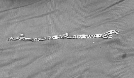 Bé gái 5 tuổi nghịch dại, bác sĩ gắp ra thứ "đáng sợ" bên trong bụng