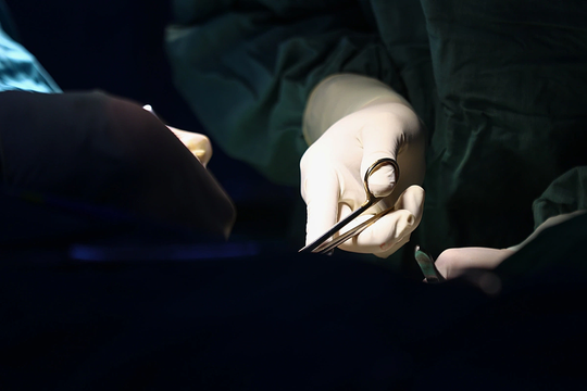 Vỡ tử cung sau tự phá thai 27 tuần