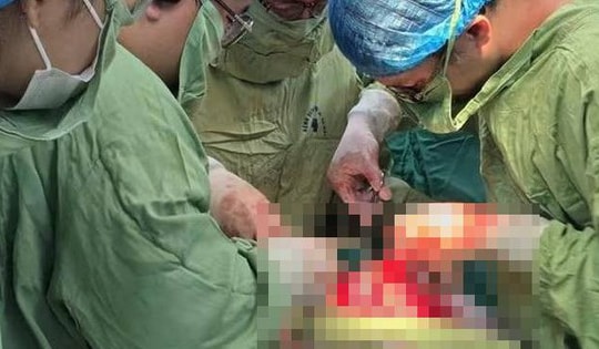 Tự uống thuốc phá thai tại nhà, cô gái 27 tuổi vỡ tử cung