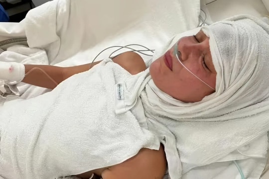 Ngày tồi tệ của siêu mẫu nội y