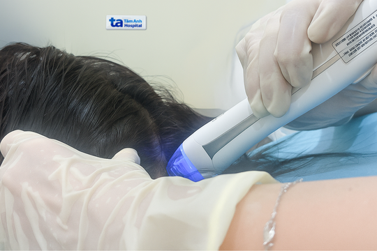 Bạc tóc tuổi đôi mươi do da đầu lão hóa sớm