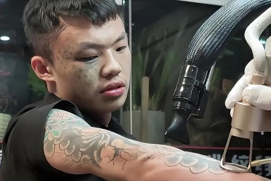 Cậu bé xăm kín mặt làm lại cuộc đời