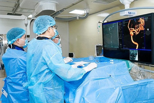 Túi phình mạch máu não gây đau đầu