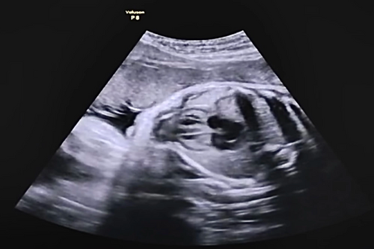 'Thời điểm vàng' quan hệ giúp tăng khả năng thụ thai