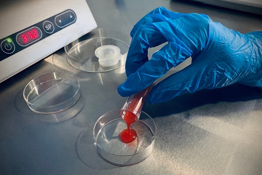 'Phác đồ Sài Gòn' - thụ tinh ống nghiệm cấp tốc, giảm chi phí