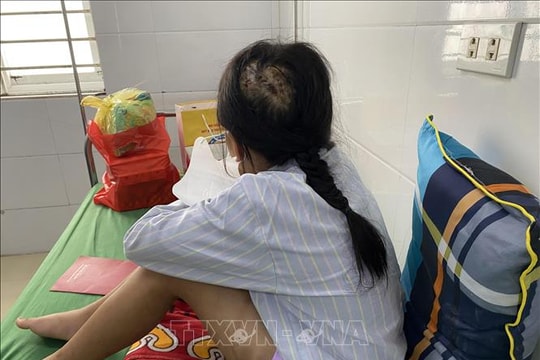 Phẫn nộ vụ việc cha dượng dùng búa đinh đánh vào đầu bé gái 9 tuổi