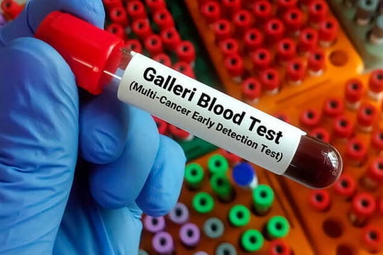 Xét nghiệm máu mới có thể phát hiện sớm hơn 50 loại ung thư