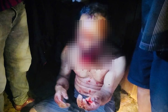 Trưởng thôn bị gấu hoang dã tấn công