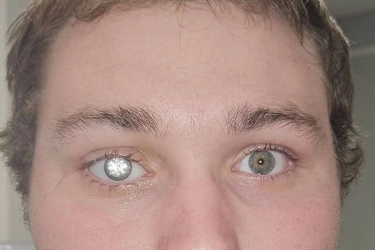 Chủ tiệm vàng đeo mắt giả gắn kim cương 2 triệu USD