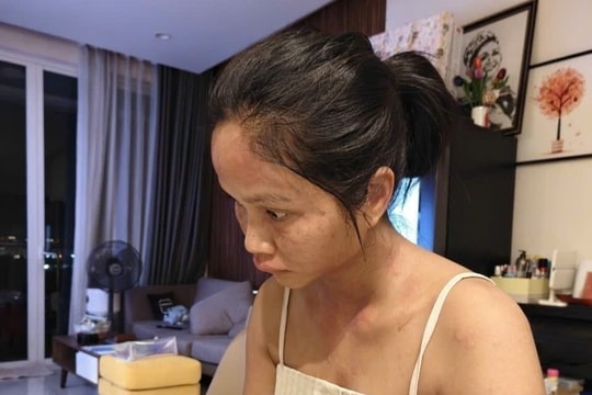 H'Hen Niê gây lo lắng