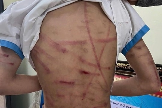 Bi kịch của những đứa trẻ bị bạo hành