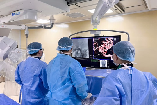 Hai túi phình động mạch não gây mờ mắt