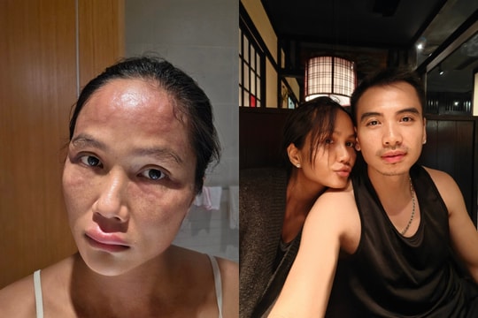 Tình trạng H'Hen Niê hiện tại