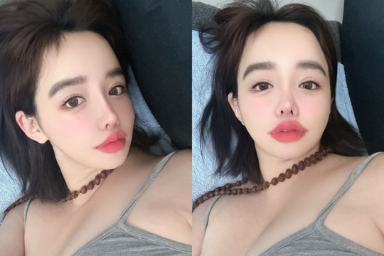 Park Bom giao tiếp khó khăn