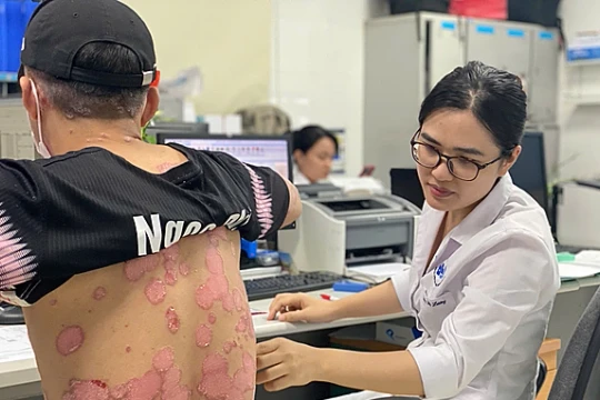 Khoảng hai triệu người Việt mắc bệnh vảy nến