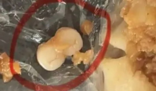 Người dân sốc nặng khi phát hiện răng người trong xúc xích, dimsum