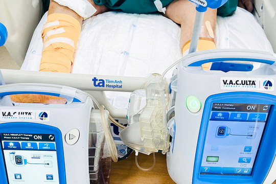 Hoại tử hai chân do biến chứng tiểu đường