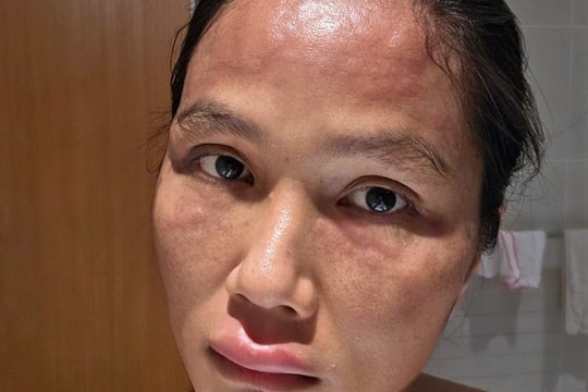 H'Hen Niê phản hồi tin 'biến dạng ngoại hình' sau sinh