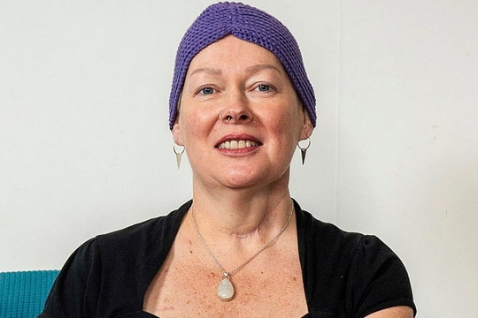 Bác sĩ lấy da chân 'vá' lưỡi cho bệnh nhân ung thư miệng