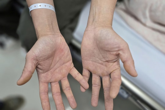 Cuộc sống bên bờ vực của cặp vợ chồng nghiện bóng cười