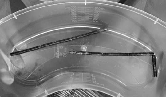 Bé trai 13 tuổi đau bụng dữ dội, bác sĩ phát hiện bí mật "đáng sợ" bên trong