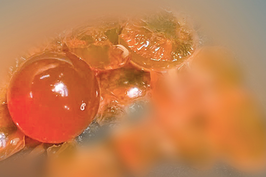 Bé trai 14 tháng tuổi nuốt nhầm hạt nở