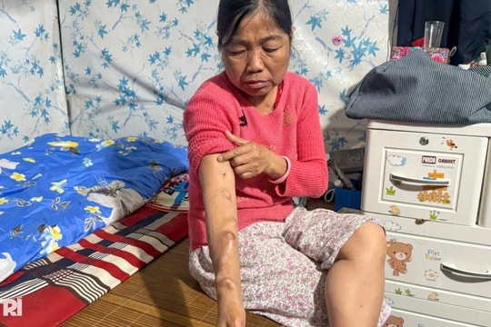 Người phụ nữ nghèo 13 năm bệnh nặng, mong được sống để báo hiếu mẹ