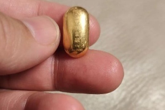 Bé trai 11 tuổi nuốt hạt đậu vàng 10 gram để 'rèn lưỡi'