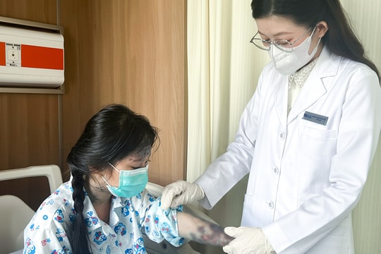 Vảy nến bùng phát toàn thân bé gái 6 tuổi