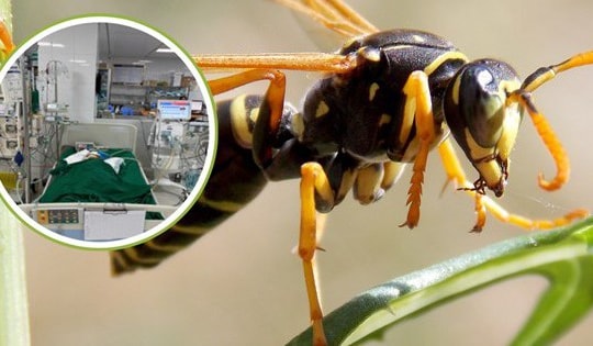 Bị ong vò vẽ đốt, bé gái 9 tuổi nguy kịch