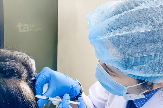 Rụng tóc hói đầu ở tuổi đôi mươi