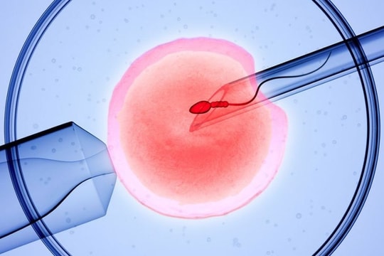 Tỷ lệ thành công của thụ tinh ống nghiệm (IVF) phụ thuộc vào những yếu tố nào?