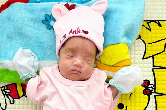 Nuôi sống bé sinh non nặng 850 gram