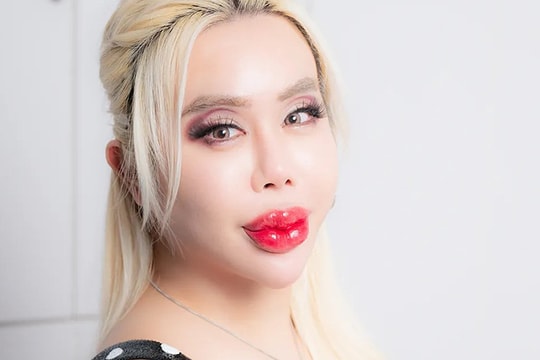 Bị bắt nạt, chàng trai Nhật chi hơn 17 tỷ đồng phẫu thuật thẩm mỹ