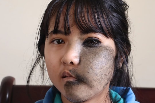 Nỗi đau ẩn phía sau lớp khẩu trang của nữ sinh mồ côi mẹ