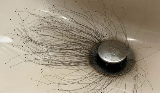 Người đàn ông sốc nặng khi thấy thứ đáng sợ mọc ra từ bồn rửa mặt
