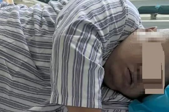 Giảm cân cấp tốc để cưới vợ, người đàn ông 134 kg tử vong