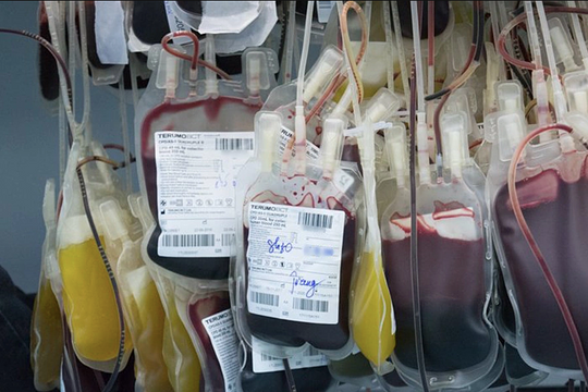 Tổn thương phổi - tai biến liên quan truyền máu