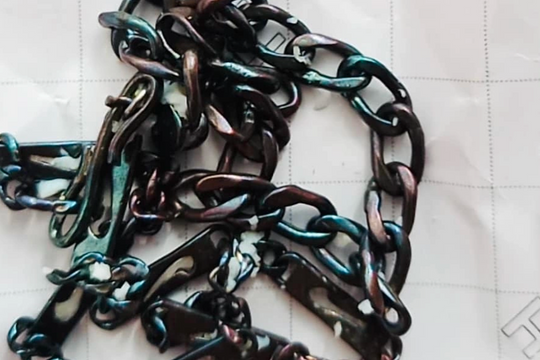 Có nên 'đánh cảm' bằng trứng gà, dây bạc, đồng xu?