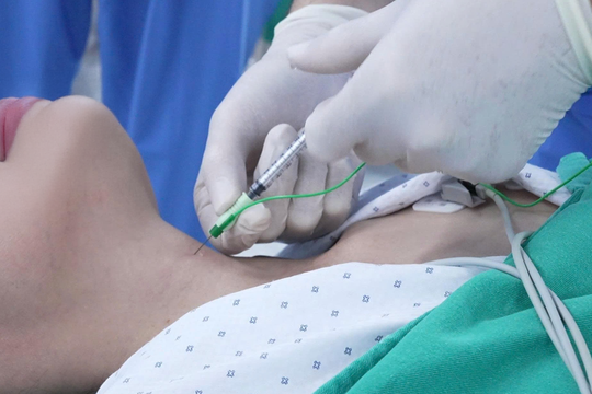 Tiêm botox giảm co cứng dây thanh quản